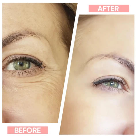 Auralane FaceLift Pro | Neck Face Firming Wrinkle Removal